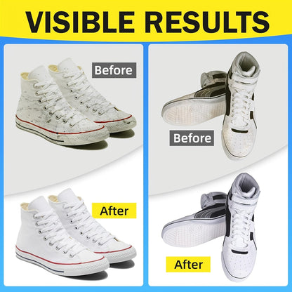Shoe Cleaning Kit - Space-Saving – view 2