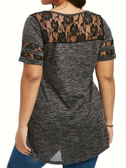 Women's Lace Detail Tunic - V-Neck Short Sleeve detail view